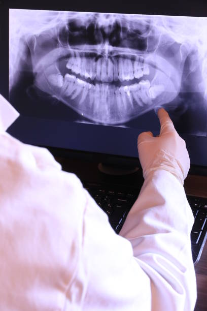Urgent Tooth Repair in TX