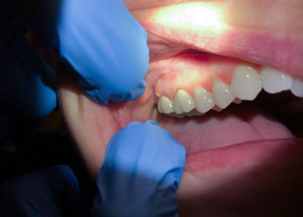 Best Broken Tooth Emergency  in Somerville, TX